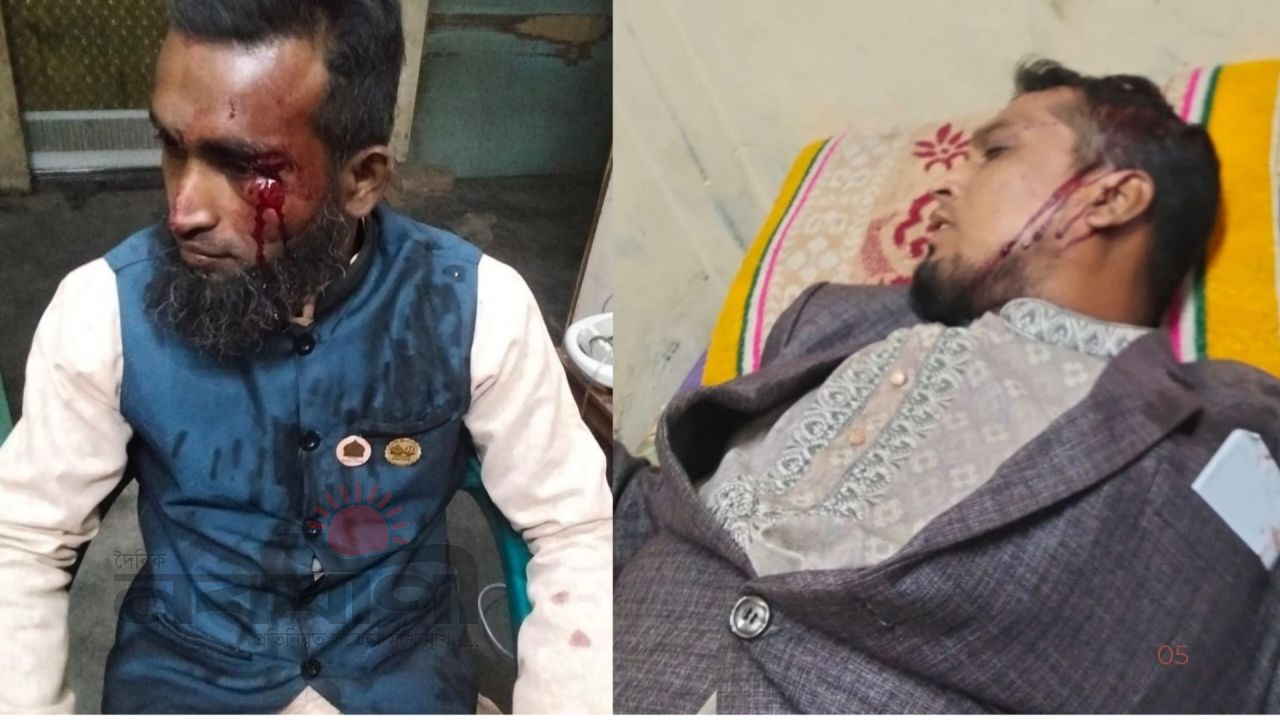 চুয়াডাঙ্গায় জামায়াত-বিএনপি সংঘর্ষে আহত ৫