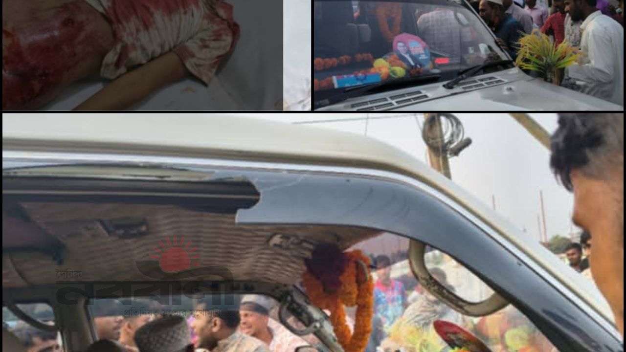 চকরিয়ায় এমপির গাড়ির চাপায় শিশুর মৃত্যু