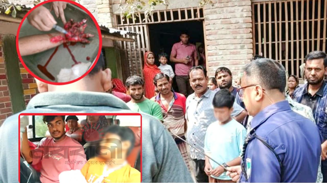 চুয়াডাঙ্গায় পটকা বিস্ফোরণে  ১ শিশুর পাঁচ আঙুল বিচ্ছিন্ন, দুই শিশু আহত