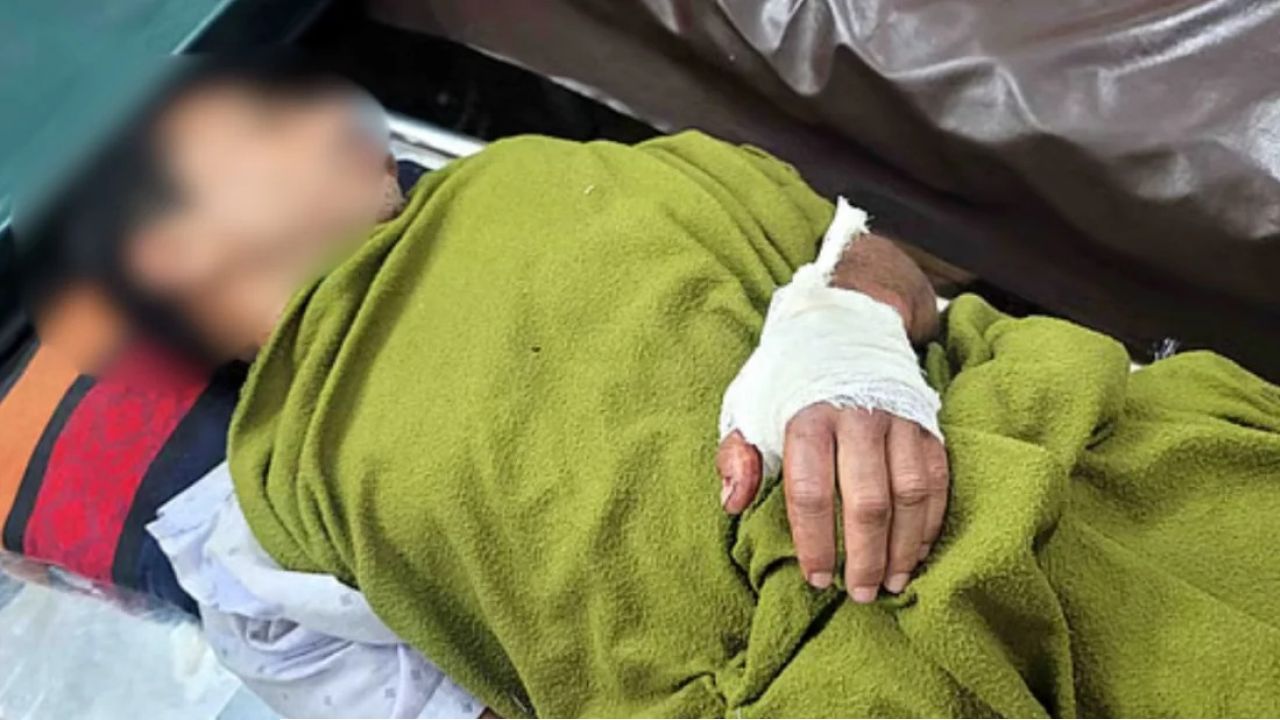 মেয়ের উত্ত্যক্তের প্রতিবাদ করায় বাবাকে মারধর ও হাত ভেঙে দিল বখাটেরা