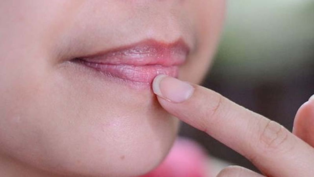 ঠোঁটের কালো দাগ দূর করার কার্যকর উপায়