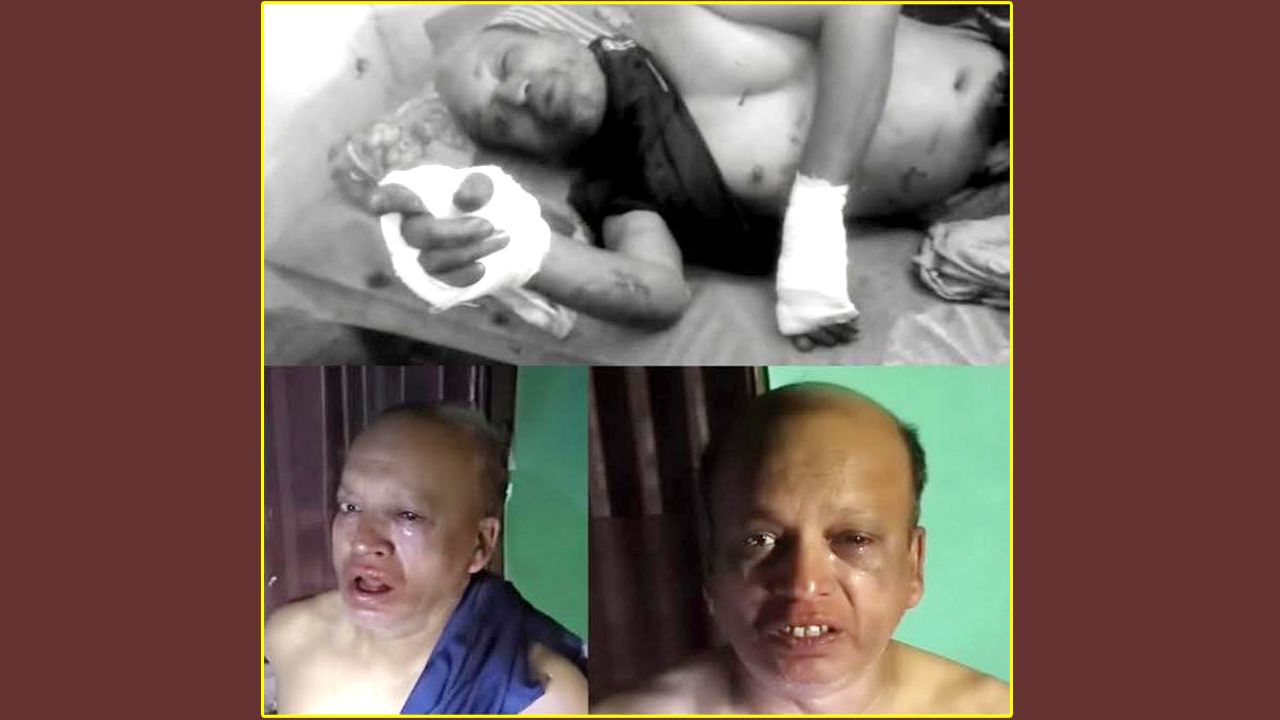 সম্পত্তির লোভে স্বামীকে হত্যাচেষ্টা, স্ত্রী-সন্তান গ্রেপ্তার