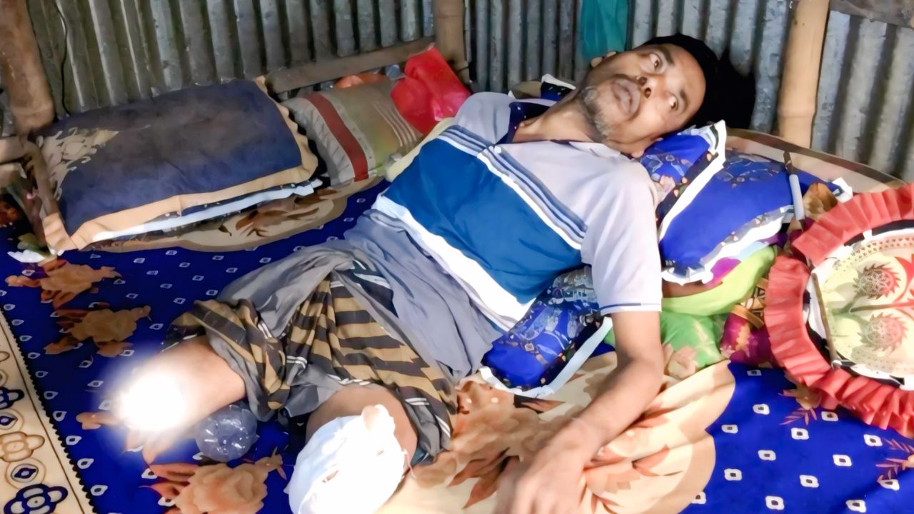 দুই পা হারিয়ে বিছানায় নুরুল ইসলাম, নিভতে বসেছে জীবনপ্রদীপ