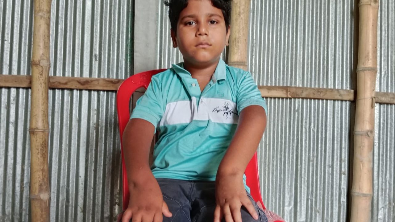 স্বাভাবিক জীবনে ফিরতে চায় শিশু মাসুদ