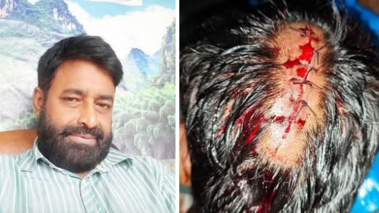 মিঠামইনে সাংবাদিক ওমর ফারুককে হত্যাচেষ্টা, রক্তাক্ত জখম 