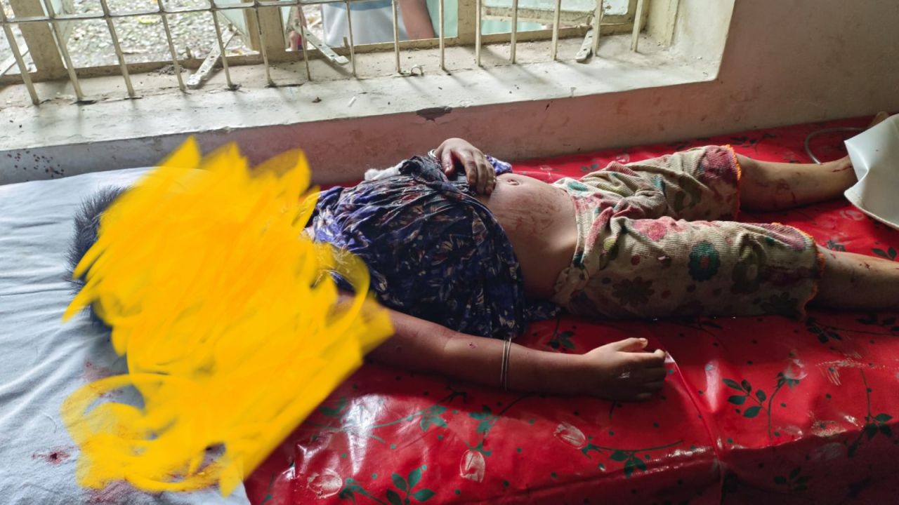 রোয়াংছড়িতে পাথরবোঝাই ট্রাকের চাকায় পিষ্ট ৪ বছরের শিশু