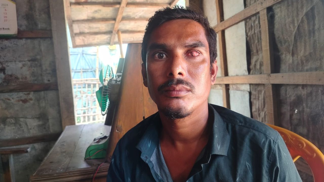 ​ভুল চিকিৎসায় চোখ হারানোর পথে ইজিবাইক চালক, চুয়াডাঙ্গার এক চিকিৎসকের বিরুদ্ধে অভিযোগ