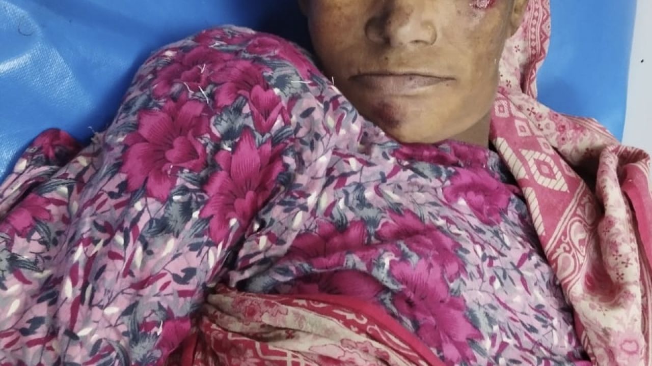 ভাঙ্গায় সড়ক দুর্ঘটনায় অজ্ঞাত নারীর মৃত্যু, পরিচয় শনাক্তে সহযোগিতা কামনা